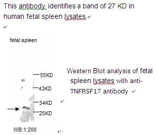 Polyclonal Rabbit anti-Human TNFRSF17 / BCMA Antibody (WB)