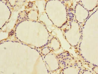 NFKBIE / IKB Epsilon Antibody