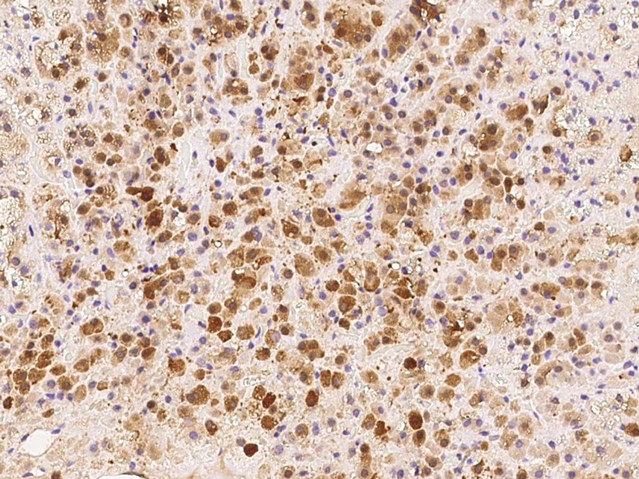 PARP4 / VPARP Antibody