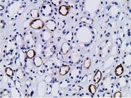Monoclonal Mouse anti-Human BCAP / PIK3AP1 Antibody (clone OTI7A11, IHC, IF, WB)