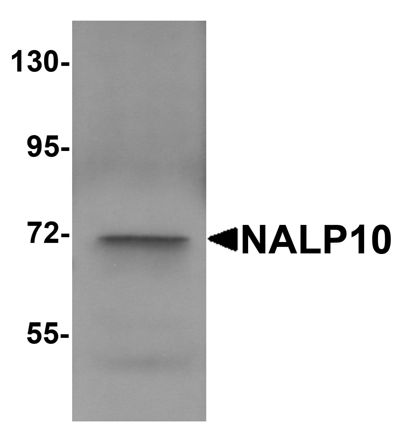 IHC-plus™ Polyclonal Rabbit anti-Human NOD8 / NLRP10 Antibody (IHC, IF, WB)