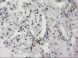 PRKCE / PKC-Epsilon Antibody (clone OTI4B3, Carrier-free)