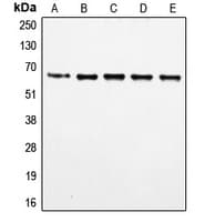 FOXO4 / AFX1 Antibody (phospho-Ser197)