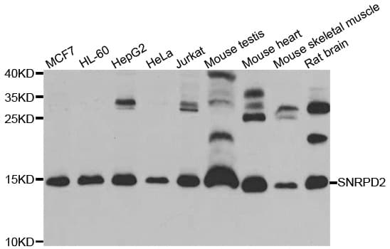 Polyclonal Rabbit anti-Human SNRPD2 Antibody (IHC, IF, WB)