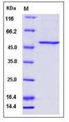 Human PAH Protein (Recombinant His,N-terminus)