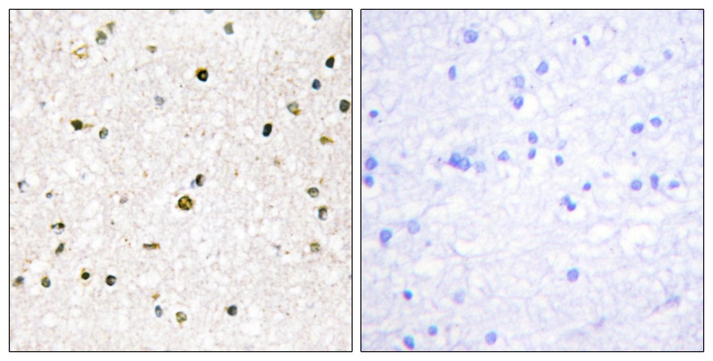 AKAP11 / KIAA0629 Antibody