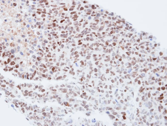 Polyclonal Rabbit anti-Human QIP1 / KPNA4 Antibody (aa459-521, IHC, WB)