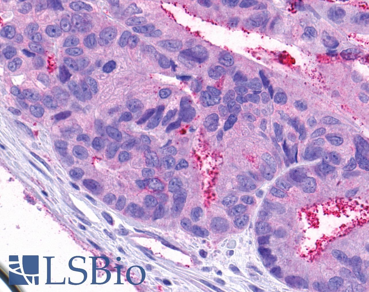 PathPlus™ Polyclonal Rabbit anti-Human NPY4R / PPYR1 Antibody (C-Terminus, IHC)