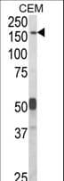 Polyclonal Rabbit anti-Human CNTNAP2 / CASPR2 Antibody (aa1079-1106, IHC, WB)