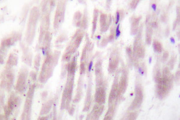 Polyclonal Rabbit anti-Human PLD1 / Phospholipase D1 Antibody (Lys556, IHC)
