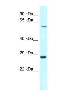 Polyclonal Rabbit anti-Human CPNE3 Antibody (C-Terminus, WB)