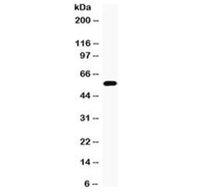 Polyclonal Rabbit anti-Human CYP17 / CYP17A1 Antibody (IHC, WB)