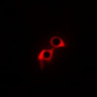 Polyclonal Rabbit anti-Human MRGPRG Antibody (IF, WB)
