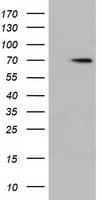 Monoclonal Mouse anti-Human HDAC10 Antibody (clone OTI1B1, IF, WB)