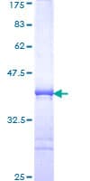 Human MEX3B / RKHD3 Protein (Recombinant GST, N-terminus)