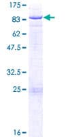 Human GALNT14 Protein (Recombinant GST)