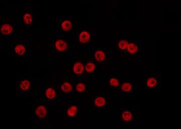 PIAS2 / PIASX Antibody