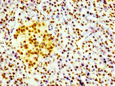 H3F3B Antibody