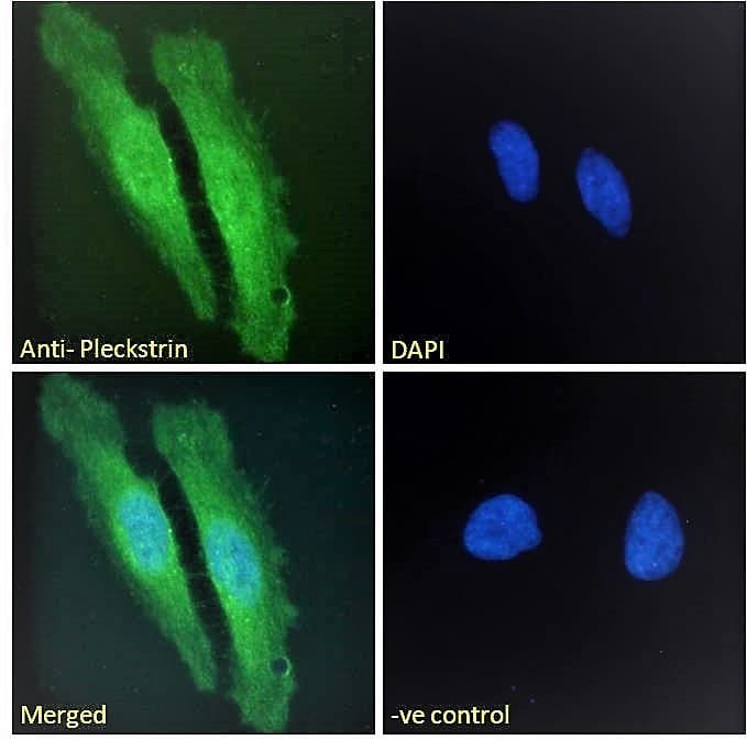 IHC-plus™ PLEK / Pleckstrin Antibody (aa337-350)