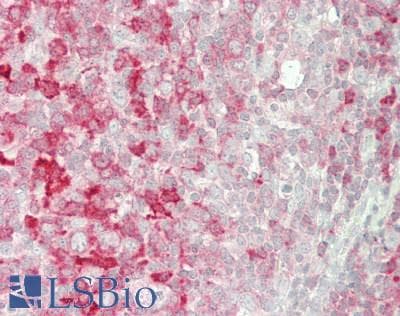 IHC-plus™ PIP4K2A / PIPK Antibody (clone 3D3)