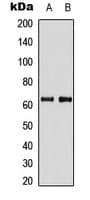 PDPK1 / PDK1 Antibody (Internal)