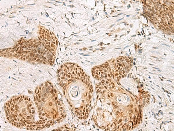 PSPC1 Antibody