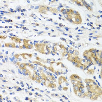 IHC-plus™ Polyclonal Rabbit anti-Human IL11 Antibody (aa22-199, IHC, WB)