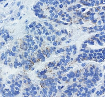 CDH1 / E Cadherin Antibody (clone UMAB184)