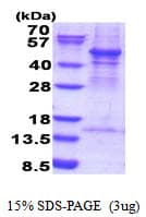 Human ACTR3 Protein (Recombinant His)
