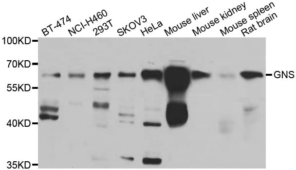 GNS Antibody