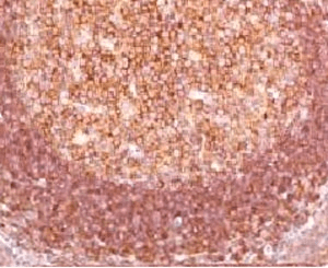 BCL10 / BCL-10 Antibody (clone MUBC10)