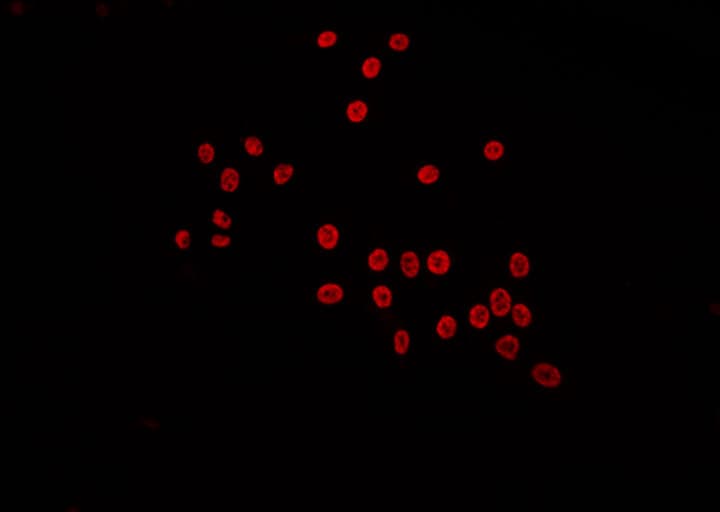 LARP1B Antibody