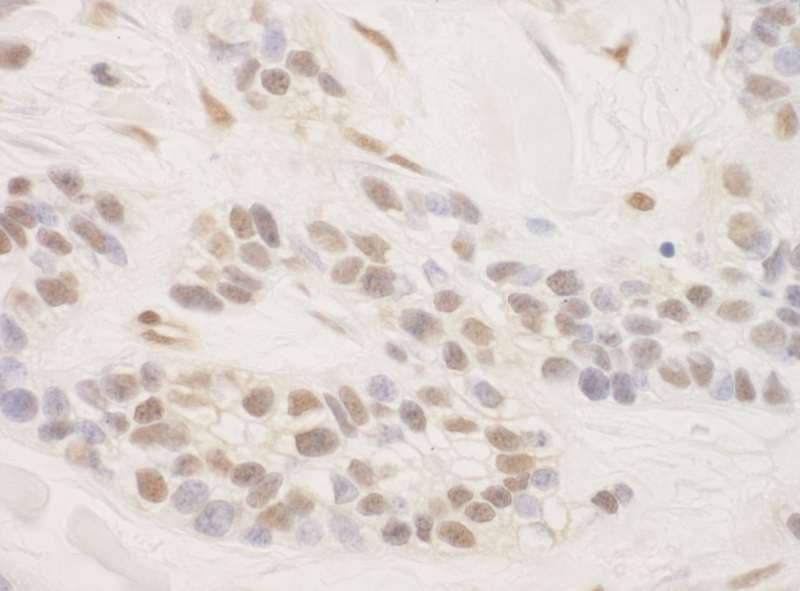 Polyclonal Rabbit anti-Human CRTC3 Antibody (aa569-619, IHC)