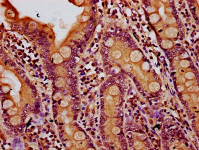 IQGAP2 Antibody