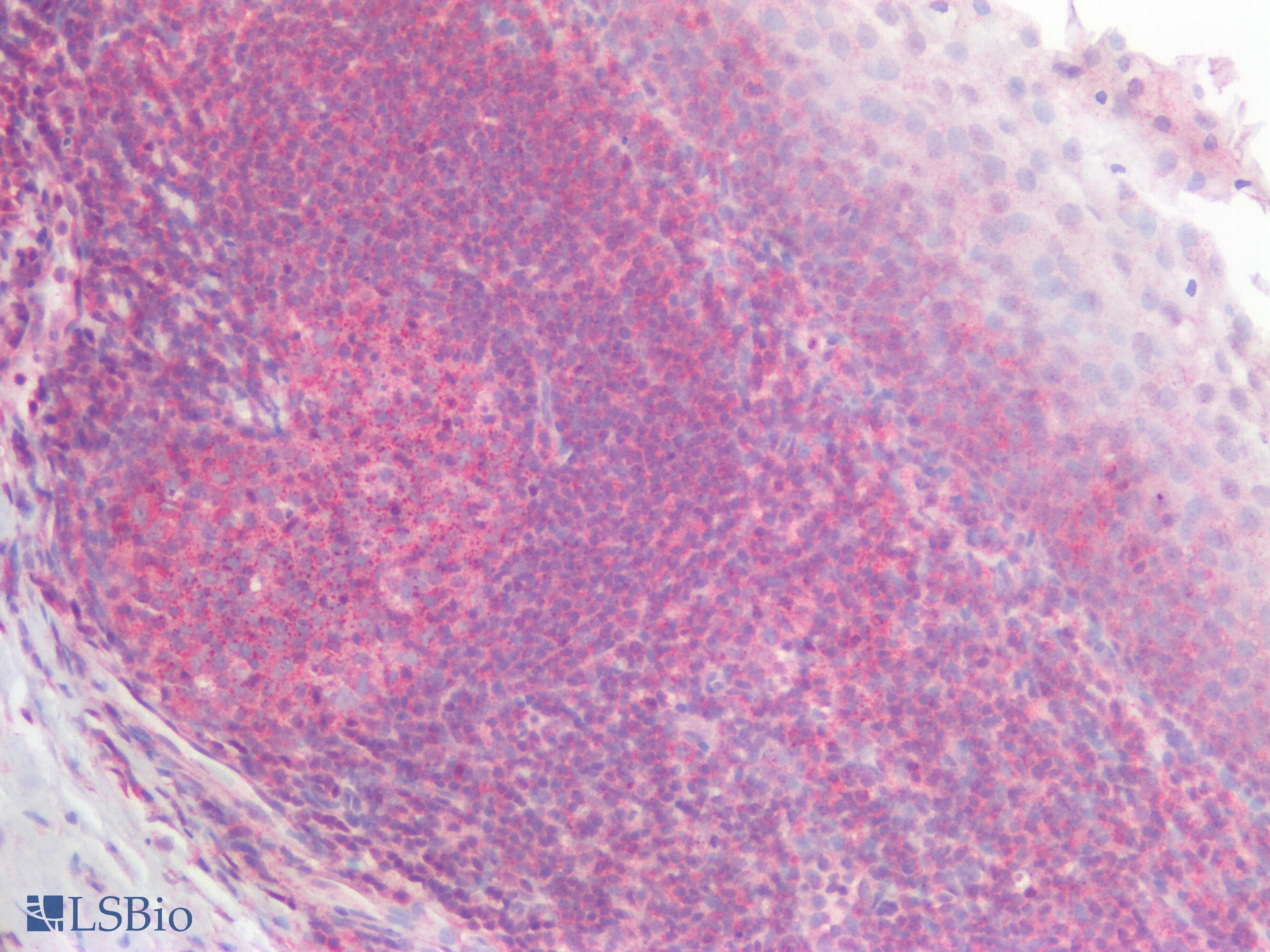 PathPlus™ Polyclonal Rabbit anti-Human SDC1 / Syndecan 1 / CD138 Antibody (IHC)
