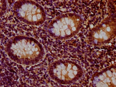 Polyclonal Rabbit anti-Human HIST1H1E Antibody (IHC)
