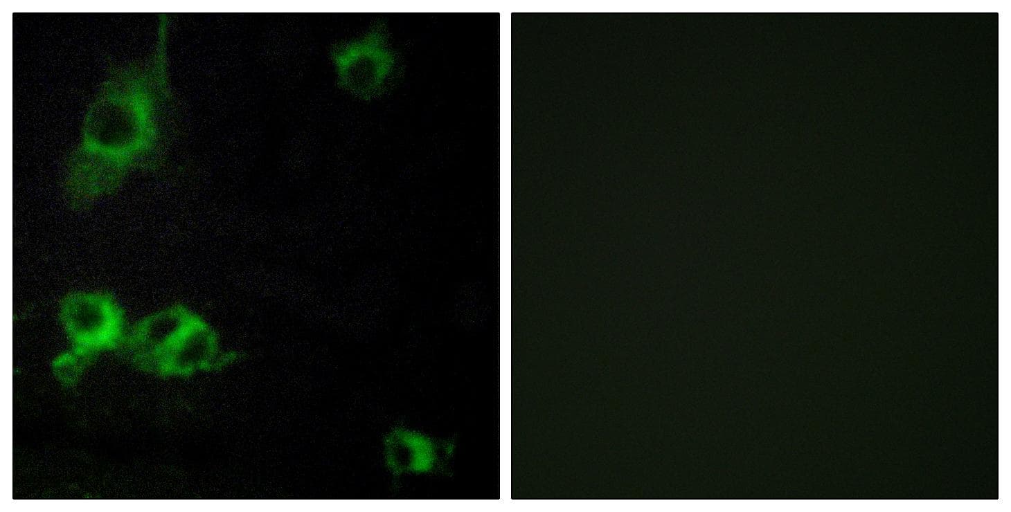 LAMA1 / Laminin Alpha 1 Antibody