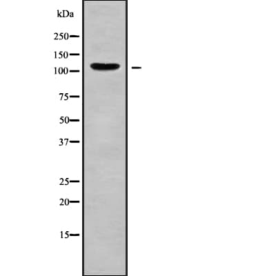 AMOT / Angiomotin Antibody