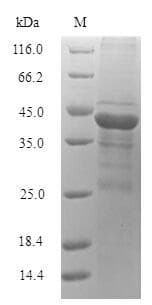 Microbacterium testaceum Acylhomoserine lactonase (aiiM) Protein (Recombinant 6His-SUMO, N-terminus)