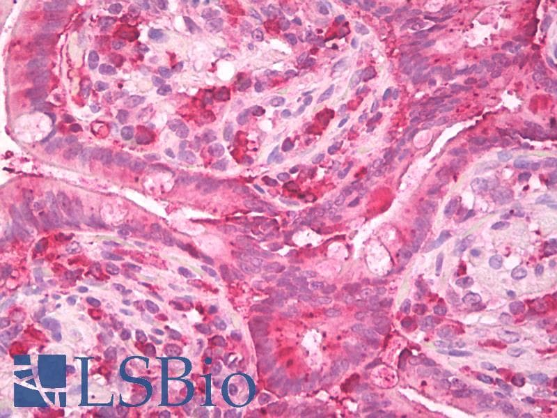 IHC-plus™ Chymotrypsin Antibody