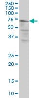 Monoclonal Mouse anti-Human CAPN5 / Calpain 5 Antibody (clone 3C10, WB)