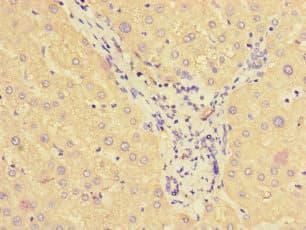 SMAP1 Antibody