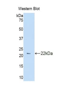 CA7 / Carbonic Anhydrase VII Antibody (aa58-217)
