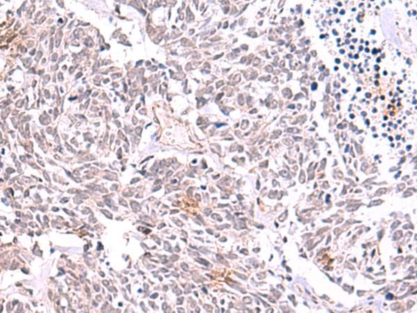 Polyclonal Rabbit anti-Human TYW2 / TRMT12 Antibody (IHC)