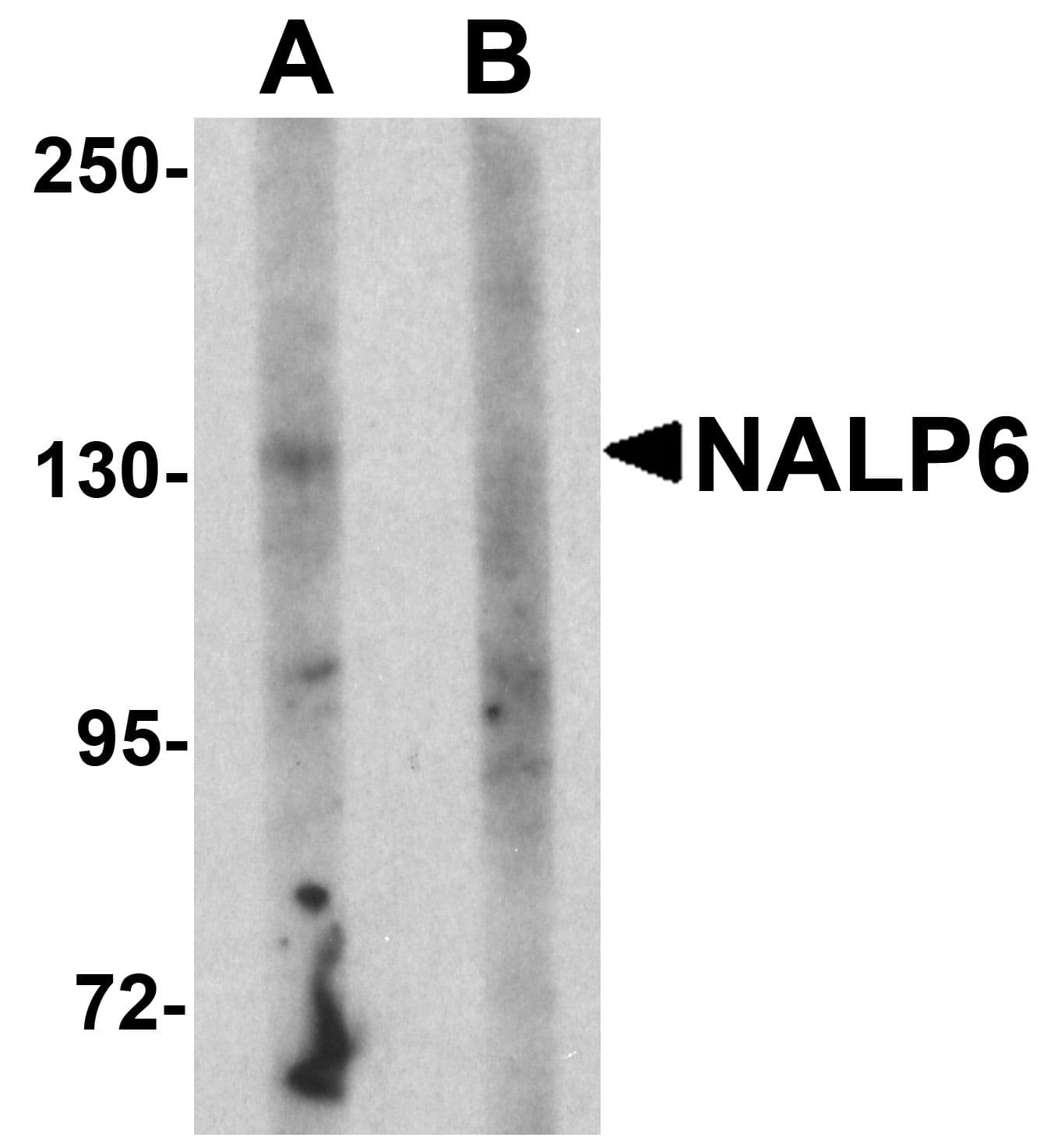 NALP6 / NLRP6 Antibody