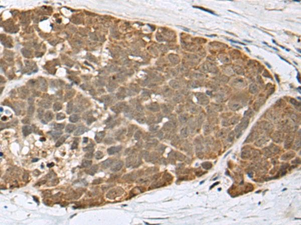 SPRTN / C1orf124 Antibody
