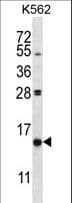 Polyclonal Rabbit anti-Human PIK3IP1 / HGFL Antibody (aa178-207, WB)