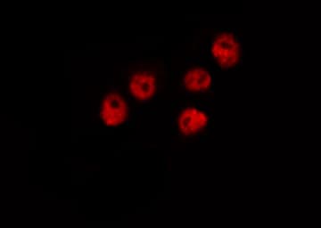 CAMK4 / CaMK IV Antibody (phospho-Thr196,pThr200)