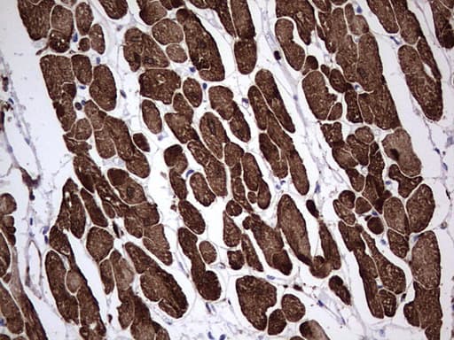 TNNC1 / Cardiac Troponin C Antibody (clone OTI9D4)