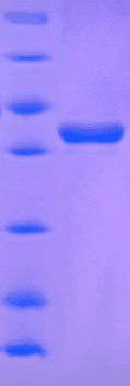 Candida glabrata ATG1 Protein (Recombinant 6His, N-terminus)